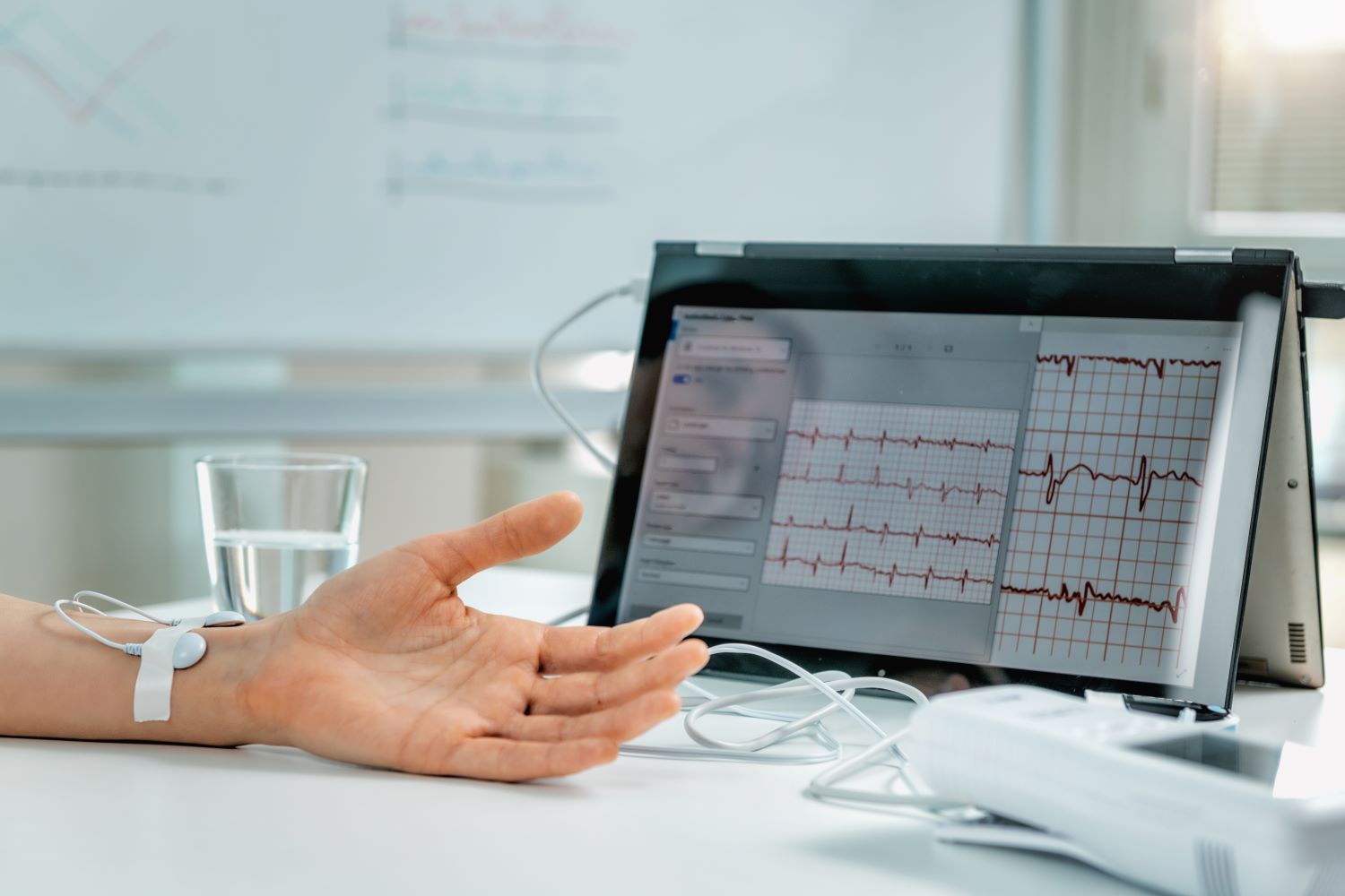 ตรวจ ekg